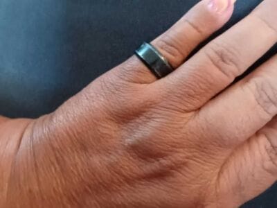 Another Awesome Day At The Local Park - 8